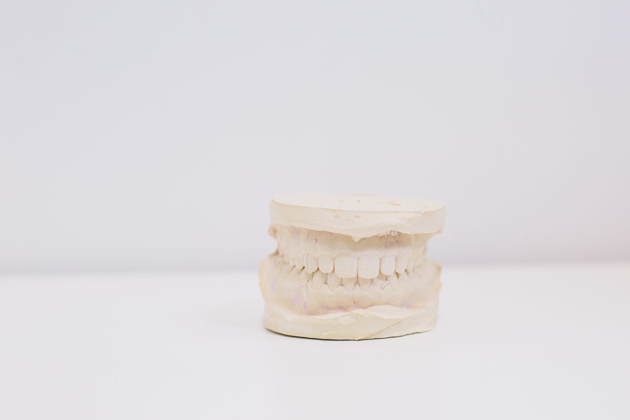 Close-up of a dental impression model showcasing teeth on a white table.
